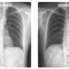 CI9JPJKO_8NCXR6SE Nexgencare Limited MOBIRAD 50 Digital Mobile X-Ray System