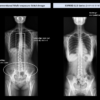 Nexgencare Limited Long Length Detector (LLD) Digital Radiography System