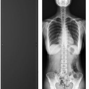 HYNXHKZ6_QXKV85MW Nexgencare Limited Long Length Detector (LLD) Digital Radiography System